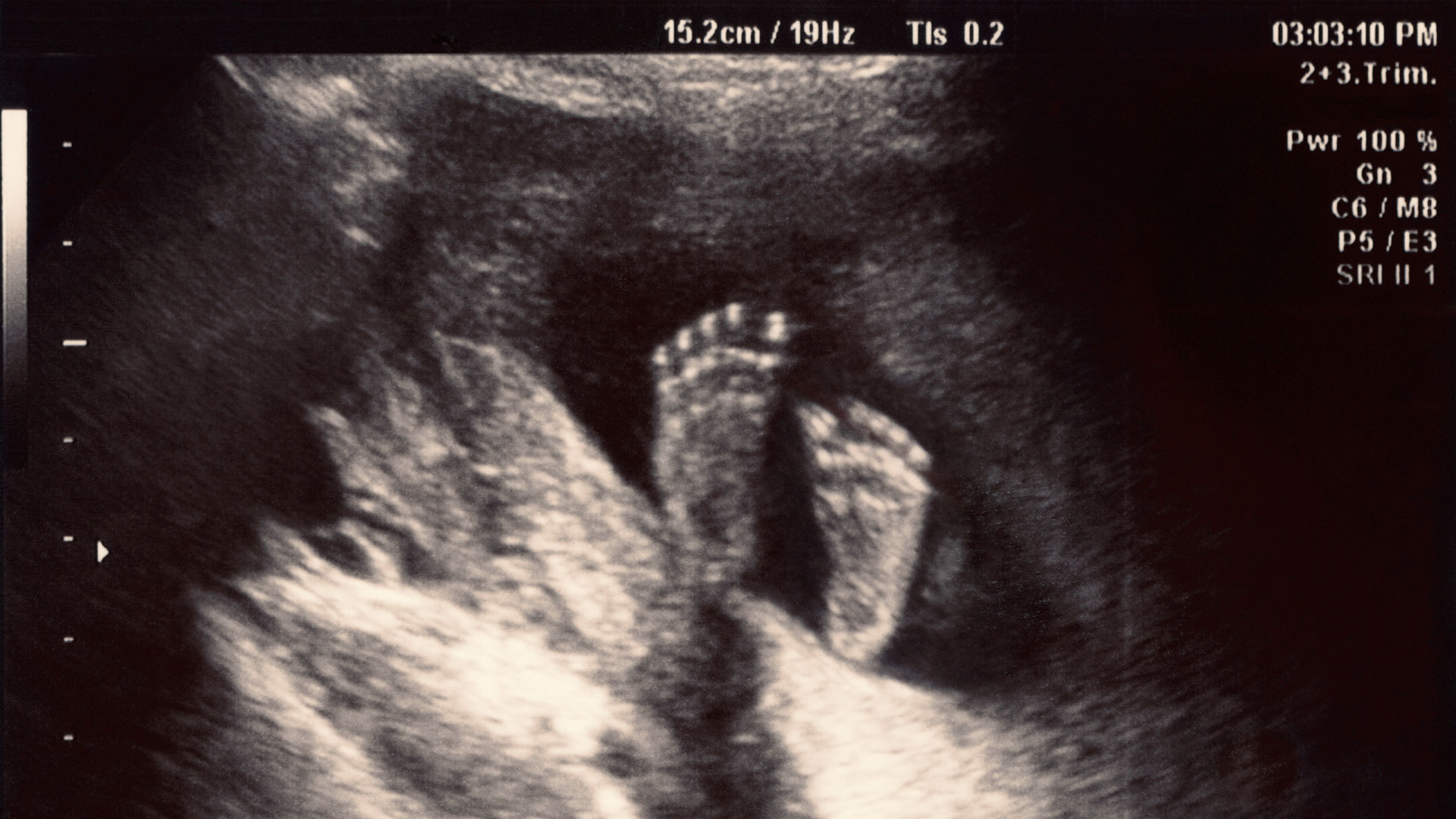 Finding Peace During Unexpected Pregnancy and Joy in Motherhood