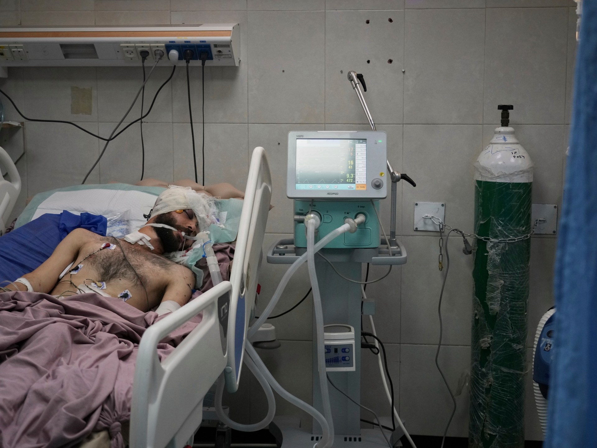Gaza’s hospitals cannot provide food to recovering patients | Israel-Palestine conflict News